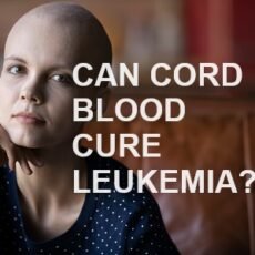 Can Cord Blood Cure Leukemia? (Debunking The Myths)