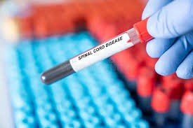 should I bank cord blood for siblings